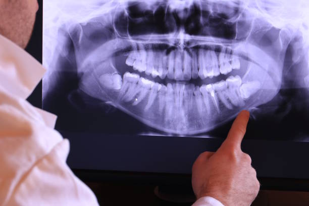 Best Emergency Dentist for Special Needs Patients in White Pigeon, MI