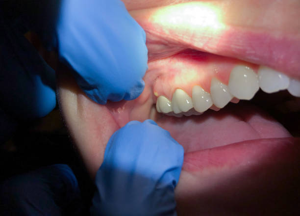 Best Weekend Emergency Dentist in White Pigeon, MI