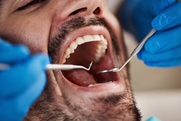 White Pigeon, MI Emergency Dentist Pros