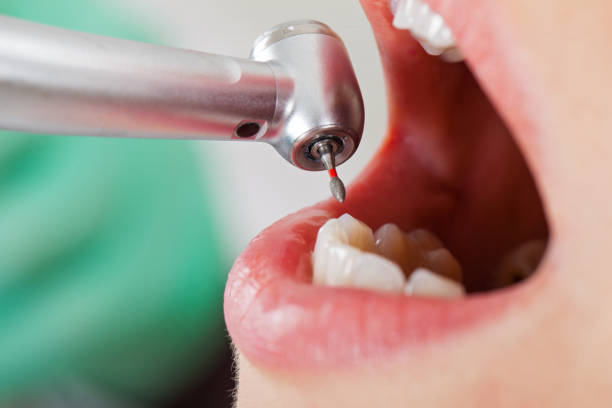 Best 24-Hour Emergency Dentist in White Pigeon, MI